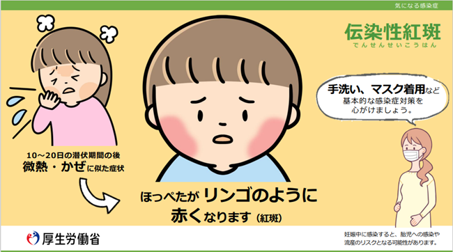 伝染性紅斑の臨床症状（厚生労働省チラシ）